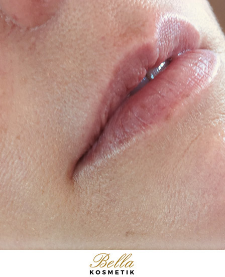 Lippen - Permanent Make-up-Behandlung - Zarrentin